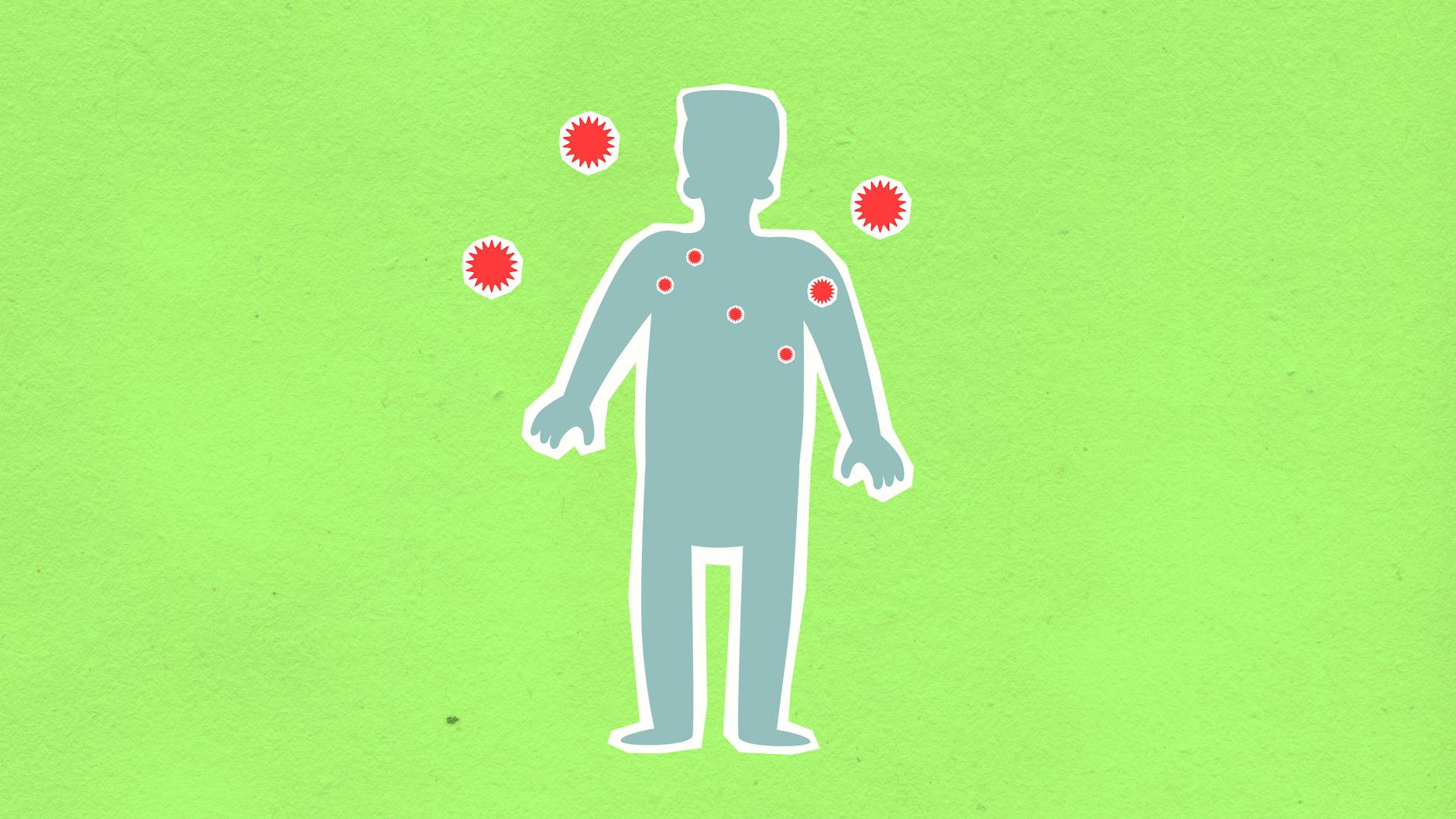 Hantavirus a Milano, finita la quarantena per due turisti britannici